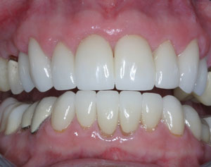 Steve Wallace Esthetic Surgery