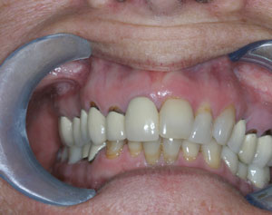 Steve Wallace Esthetic Surgery